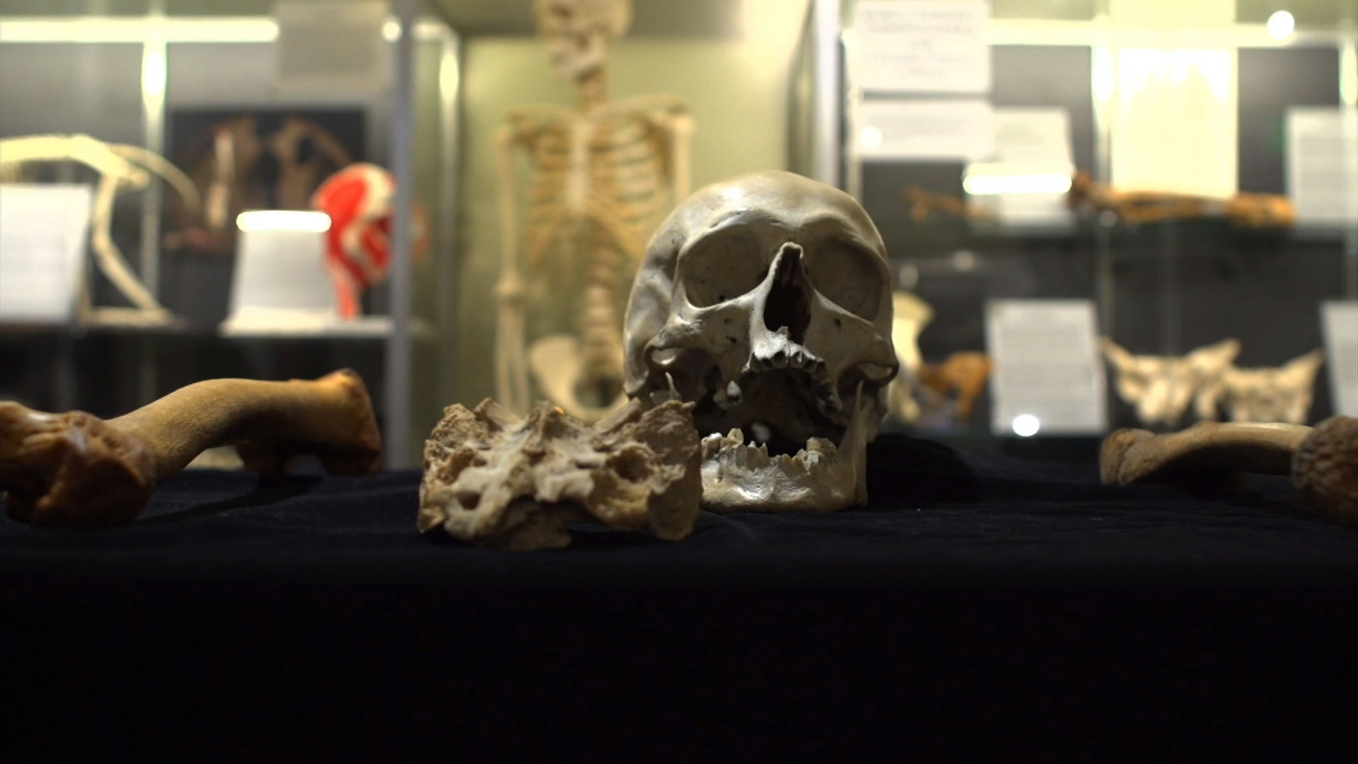 skulls and other bones on lab table